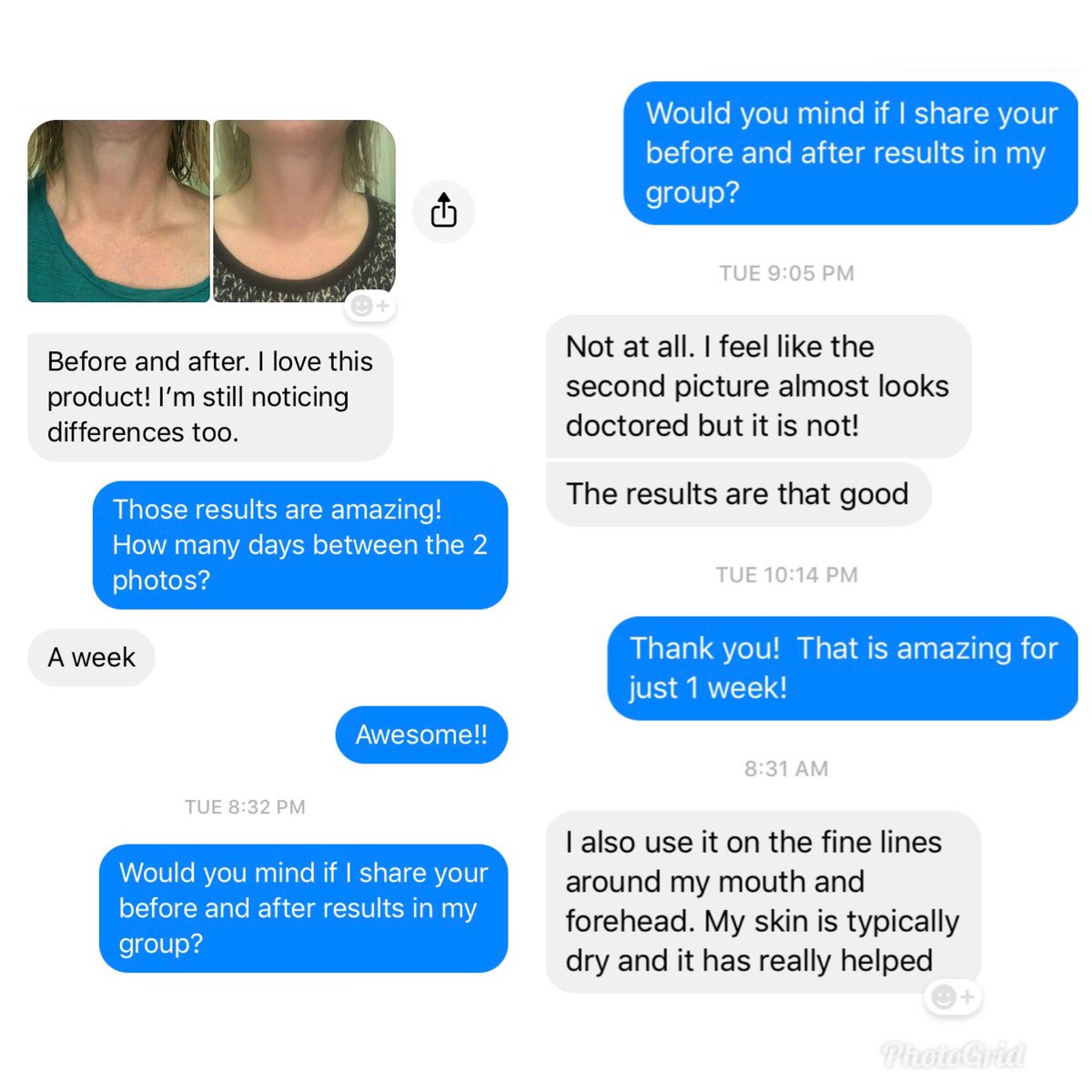 SaluteToBeauty's tweet photo. The Before/Afters of our new neck cream are incredible in...DAYS OF USE!!  Check out one of my personal customer’s results &amp; feedback 😱.

#crazyrealresults #notjustforoldpeople #notjustforwomen #liftingandfirmingneckcream https://t.co/FK1eFy1jvq