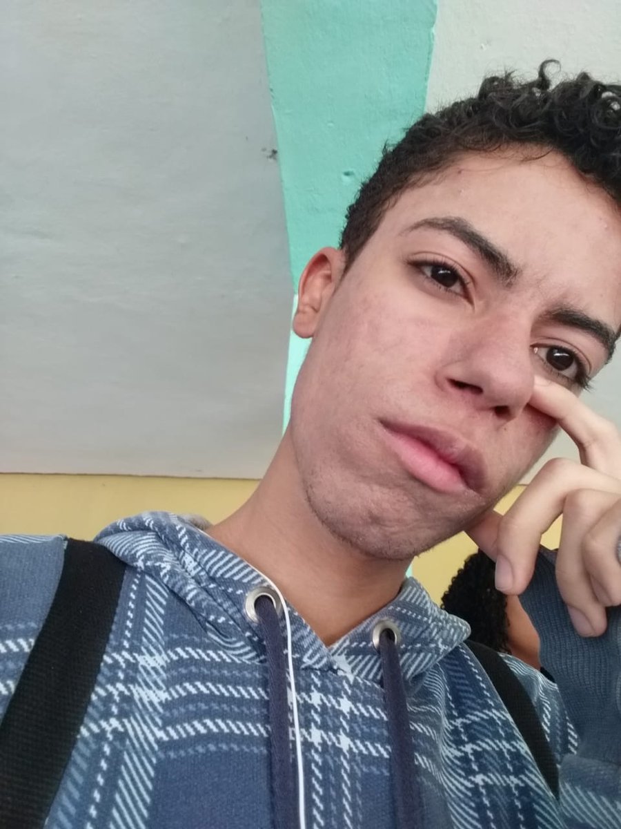 bitchtys's tweet photo. em 4 meses tomando o roacutan o meu rosto já MELHOROU MUITO AAAAAAAAAA PUTA QUE PARIU
te amo seu veneno https://t.co/HoaUsshmwr