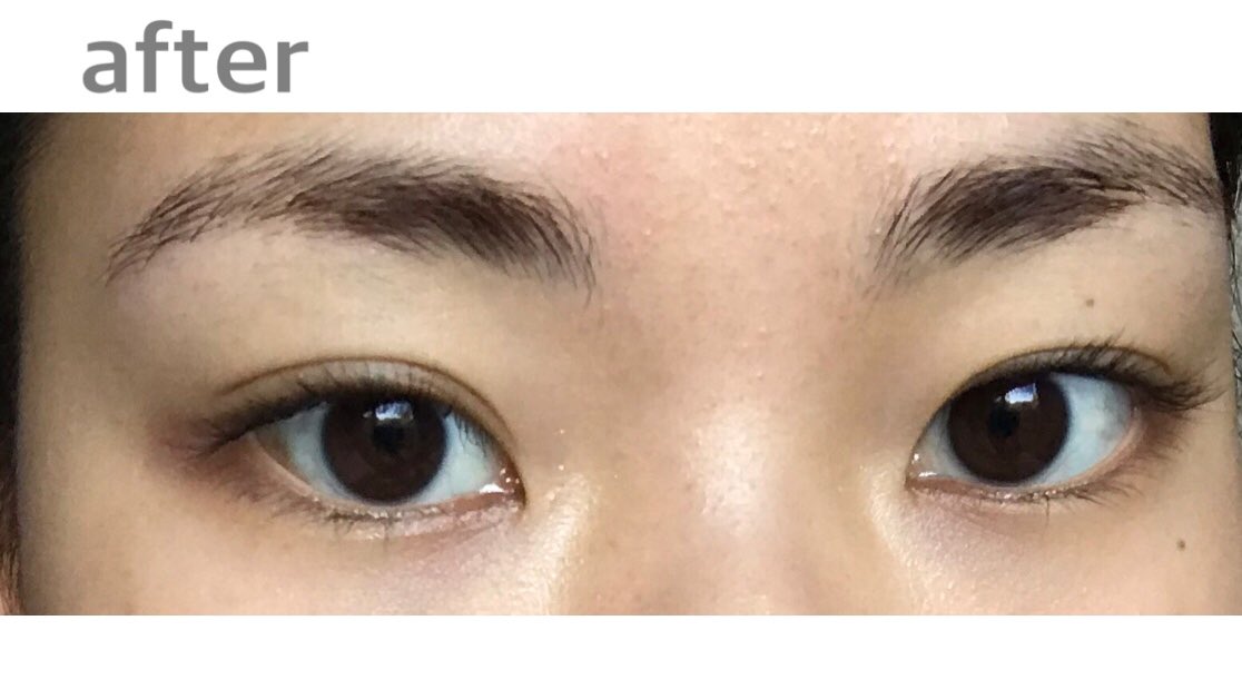 不摂生の賜物ちゃん 初めてのセルフ眉脱色 ピリピリして心配だったけど 肌が赤くなったりとかは今の所ない 眉毛が本当に剛毛過ぎて一回じゃ脱色感は微妙 一応眉毛の主張はちょっと減らせたかなって印象 明日またもう一回脱色チャレンジしてみる