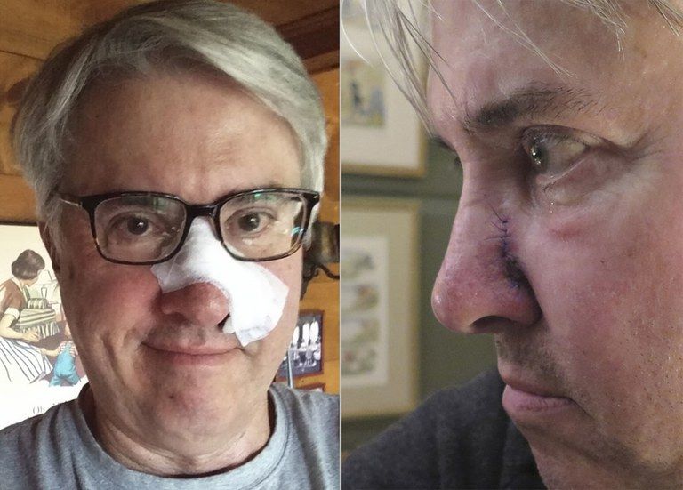 CanadianSkinCancerFd tweet media