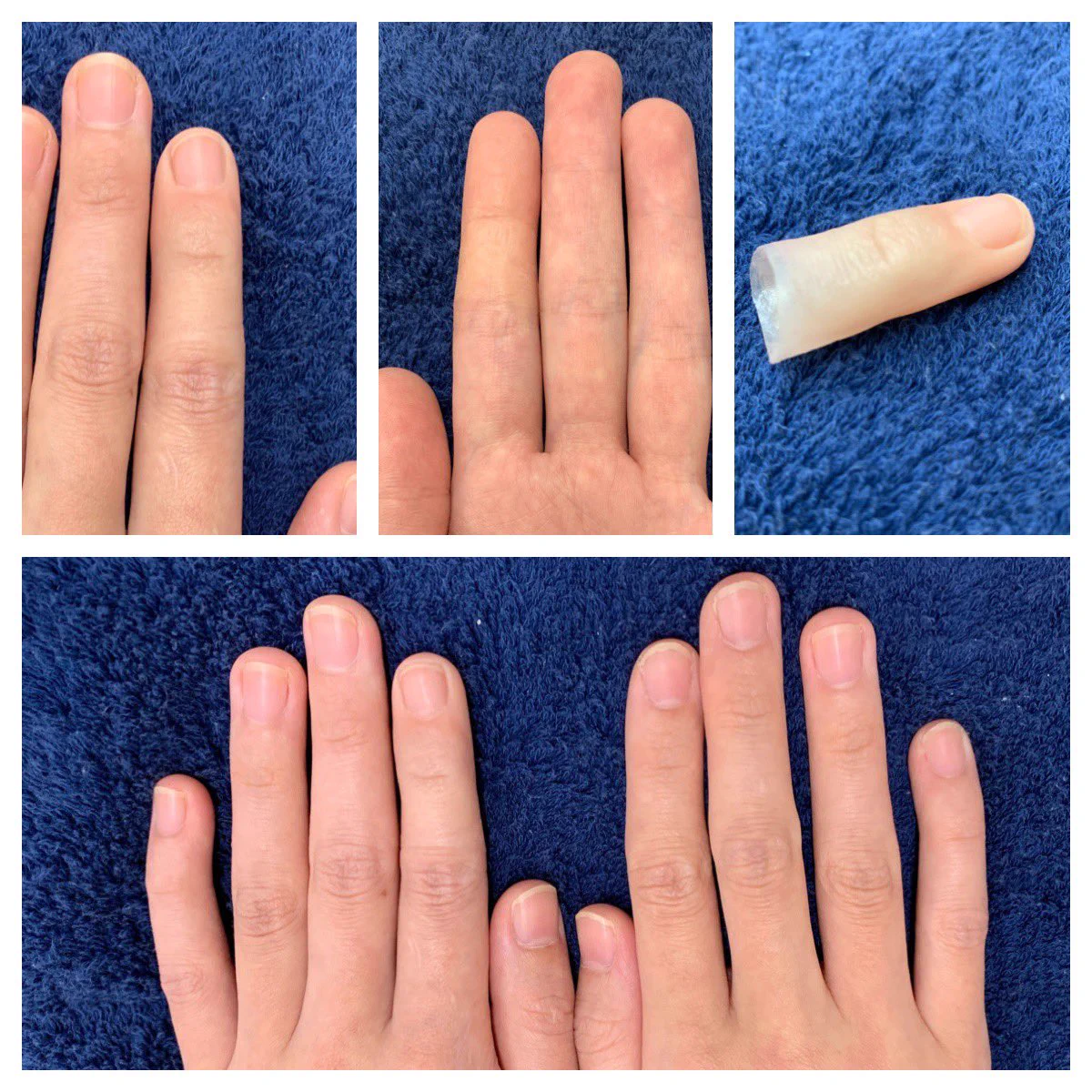 これ本当に義指ついてるの！？精巧すぎる技術がすごいwww