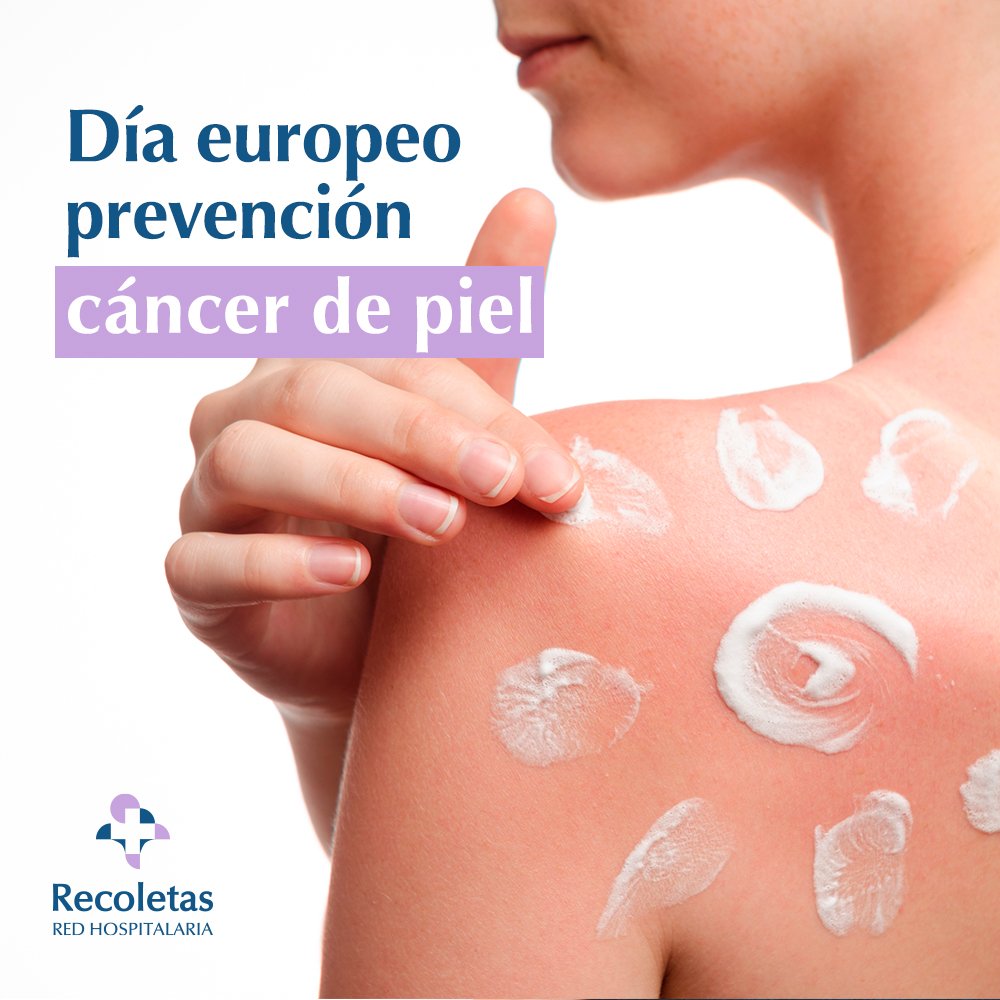 RecoletasSalud's tweet photo. 📅 #DíaPrevencionCáncerPiel 👇

Gestos tan sencillos como aplicarse un protector solar 🌞 es suficiente para prevenir el #CáncerdePiel. ⚠️ Ponte #protector siempre que hagas una actividad al aire libre ⇢ https://t.co/33cfFEI1Gd 

#Salud #VidaSaludable #Prevención #Concienciación https://t.co/MfVcumsbBe