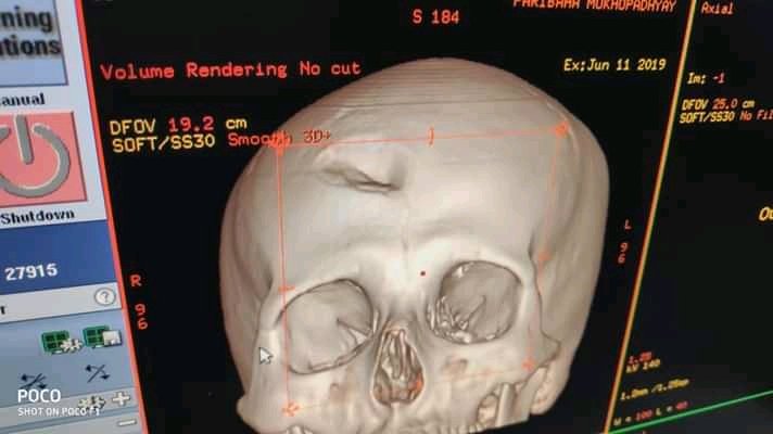 krish16maj's tweet image. #Savethedoctors
Hlp us pls,even our hostels are being set on fire,the doctrs are under constant attack,female doctrs are under acid attack n r molested..pls help us.
@narendramodi @smritiirani @ArnabGoswamiRtv @ndtv @republic @rajnathsingh @AmitShah @DilipGhoshBJP  pls help us