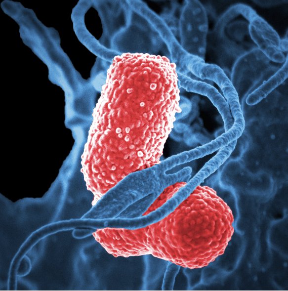 GermReport's tweet photo. Name that Germ! 🦠🔬🧬
Enters the respiratory or urinary tracts, can cause infection and leads to pneumonia and urinary problems!
Answer⬇️
#bacteria #germs #microbiology #microbes #epidemic #cdc #globalhealth #publichealth #hygiene #optisolve #foodprocessing #sanitation https://t.co/SBmiyMTdpB