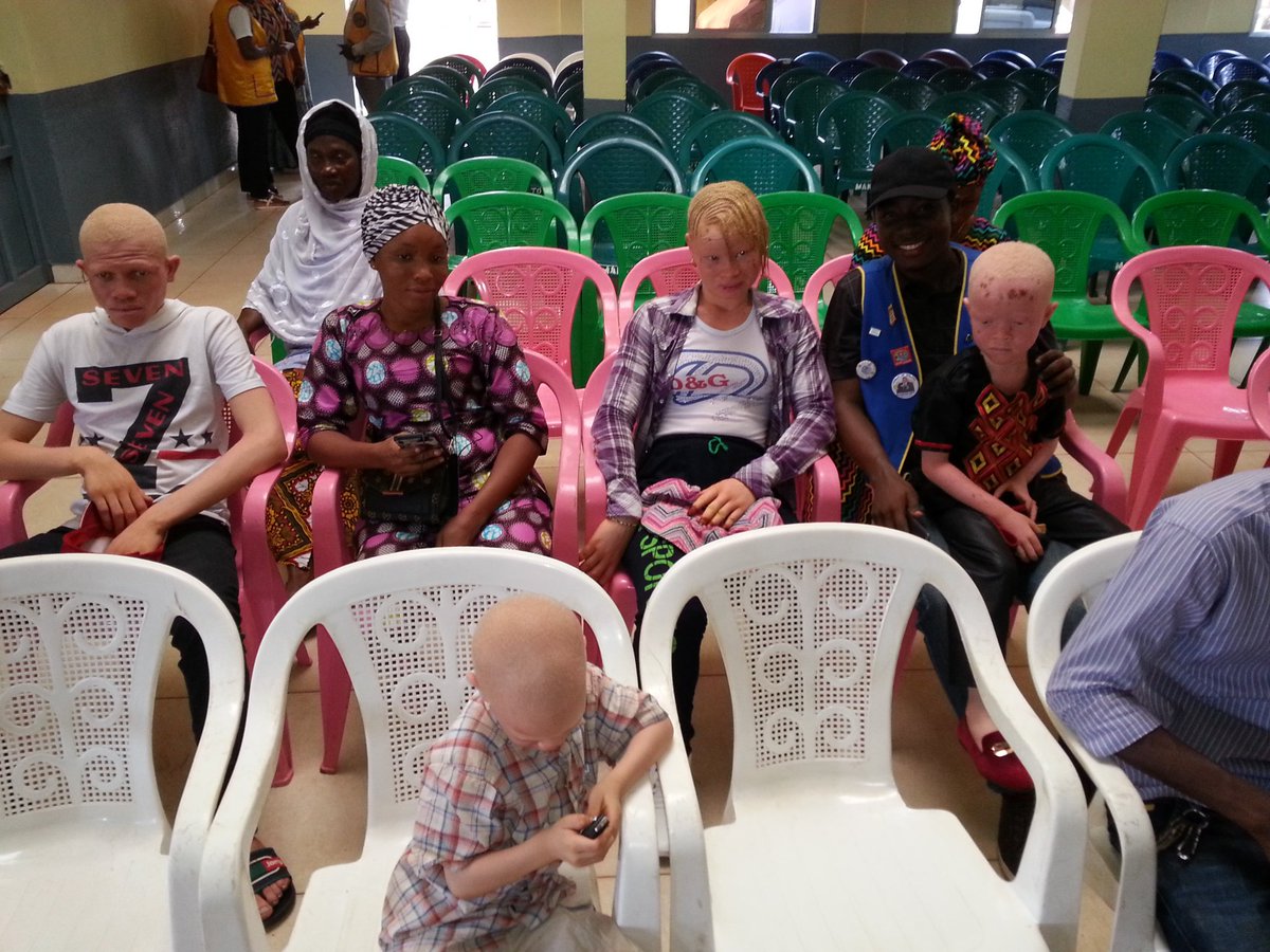 BaldeSaid94's tweet photo. Don d'habits,chaussures aux albinos à l'occasion de la journée internationale sur la sensibilisation de l'albinisme par le Lions club de Guinée.
#LionsClub
#weServe. https://t.co/DbMcgATUcB