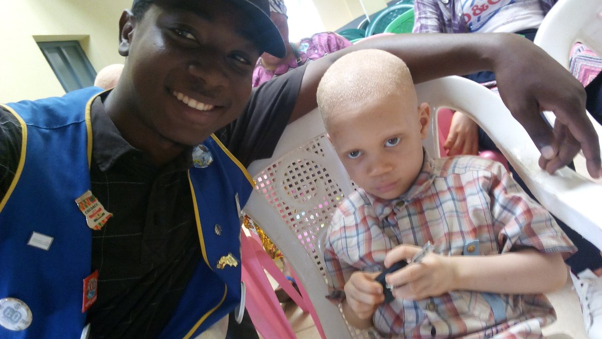 BaldeSaid94's tweet photo. Don d'habits,chaussures aux albinos à l'occasion de la journée internationale sur la sensibilisation de l'albinisme par le Lions club de Guinée.
#LionsClub
#weServe. https://t.co/DbMcgATUcB