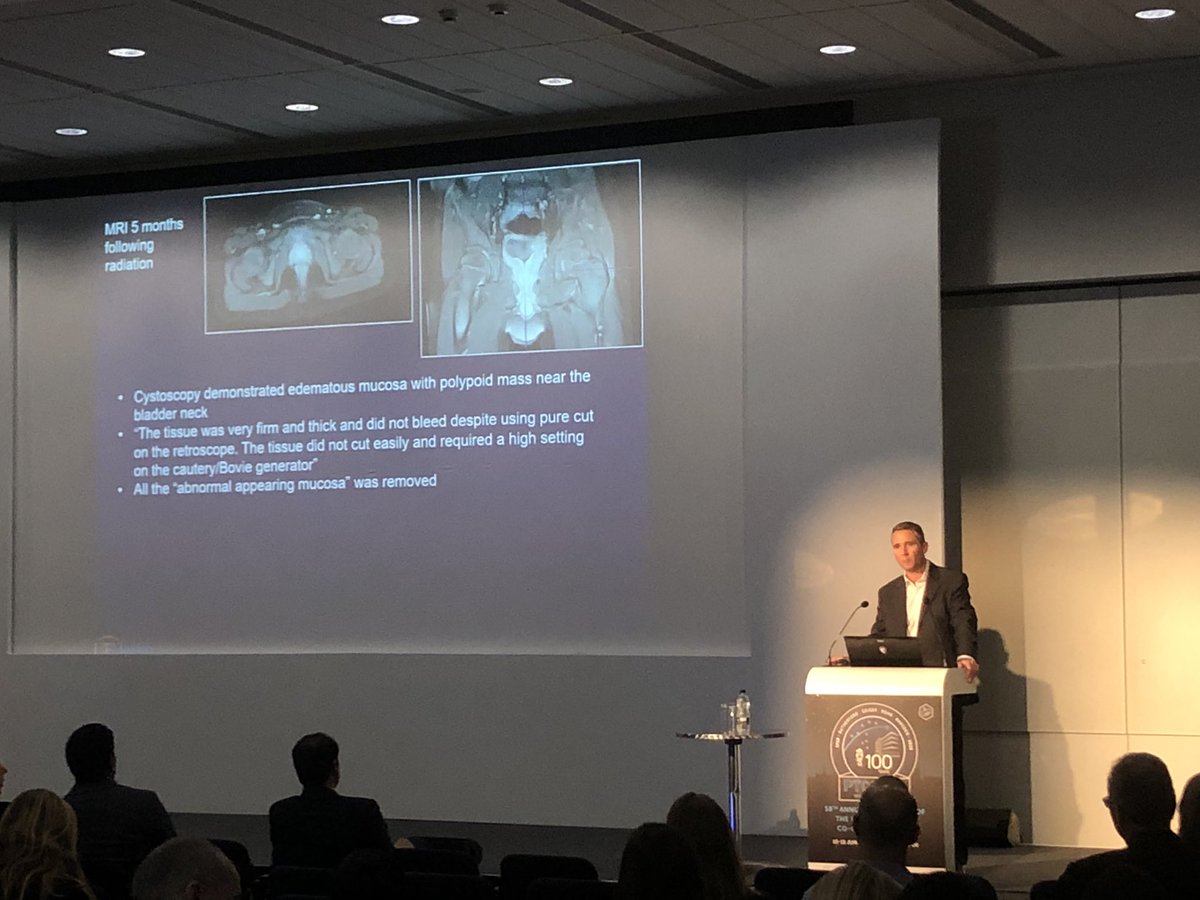 Danny Indelicato’s oral presentation demonstrating favorable outcomes in  pediatric pelvic rhabdomyosarcomas following proton therapy. Excellent work following your patients carefully to produce this work.<a href="/PTCOG58/">PTCOG</a> <a href="/UFHealth/">UF Health</a> <a href="/UFProtonTherapy/">UF Health Proton Therapy</a>