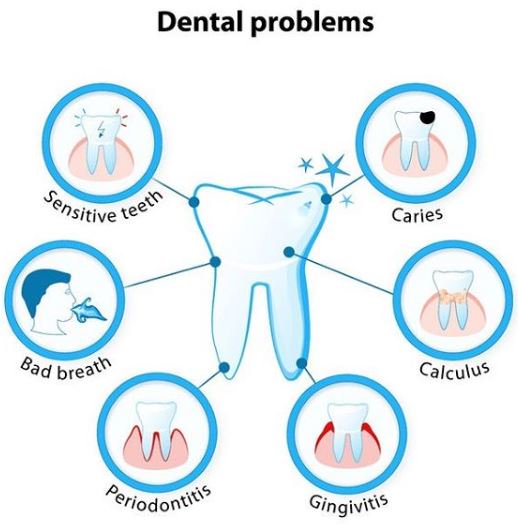 OmniDentalGroup's tweet image. Any sensitivity, bad breath or pain is a signal to get your oral health examined. Call to schedule an appointment at one of our 3 Austin locations {North ~ Jollyville ~ William Cannon}

#dentalhealth #healthyteeth #sensitivetooth #healthyhabits #atxdentist #halitosis