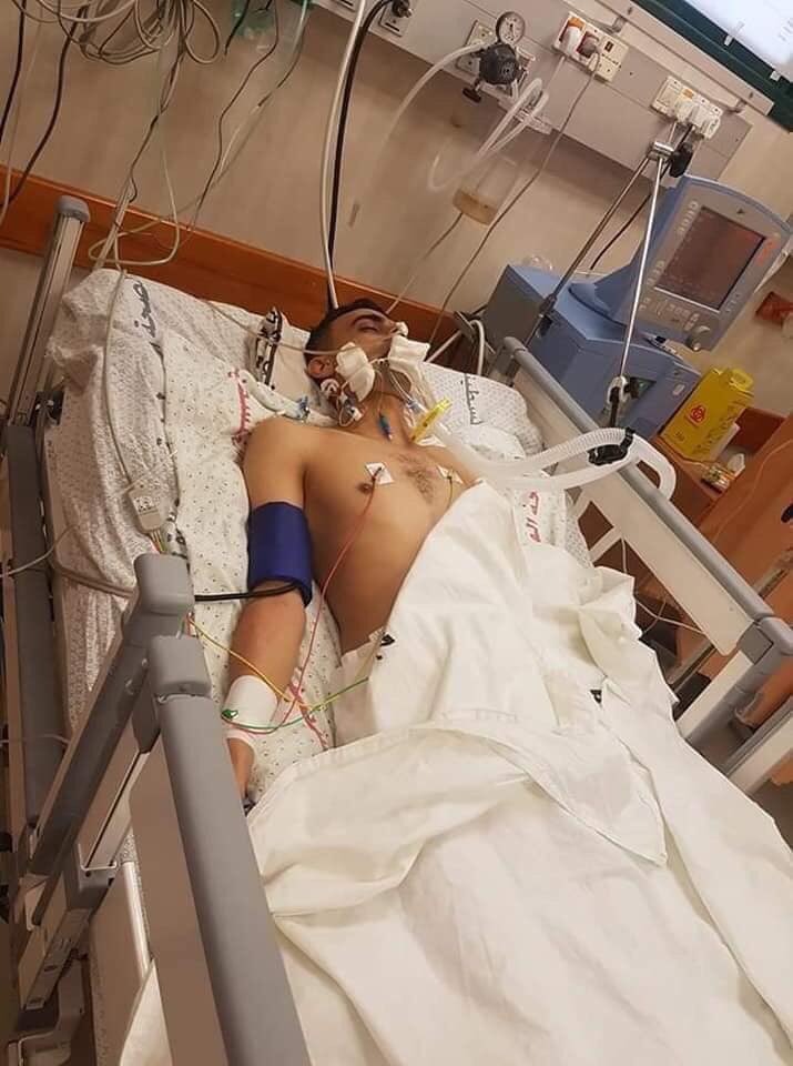 Betelgeuse100's tweet photo. Murdered paramedic, the Martyr Mohammad Judeili, after he was shot in the face by Israeli death squads last month in Gaza, &amp; died this week
His “crime” was saving the lives of Palestinians who were demonstrating for their basic human rights
#GroupPalestine 
#قروب_فلسطيني https://t.co/Yq4OiLHihA