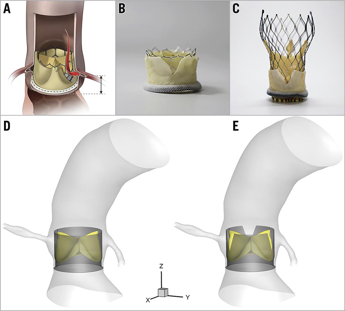 EuroIntervention tweet media