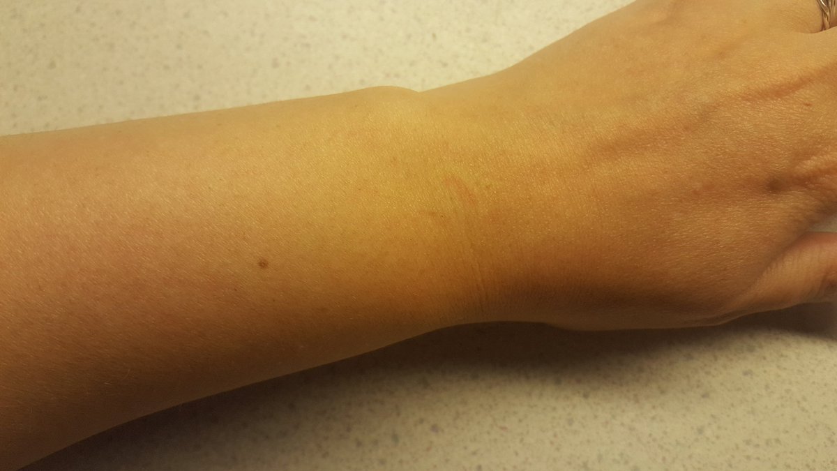 So I heard this thing about all women having a freckle on their left wrist. Thought I don't... Until I looked!! 😮 What is this vodoo?? #frecklewrist