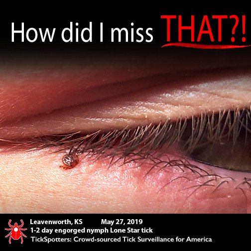 thetickguy's tweet photo. Don’t miss your chance to help TickSpotters-CAN TICK PICS PREVENT #LYME and other TBDs? Only 11 days left – meet crowdfunding goal or get nothing!! Harsh. Please help…right now. https://t.co/XKyybhxi9D. @catharob @trieverything @corystieg @RichLouv https://t.co/gjc2020sPT
