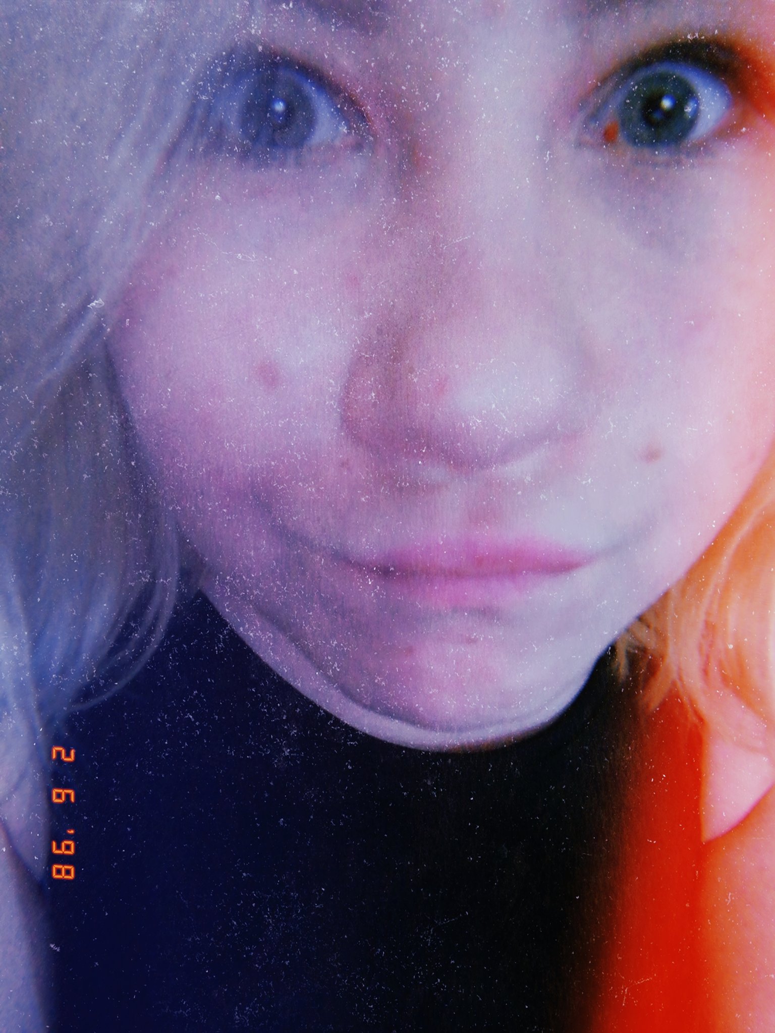 vikalivat-glaza-telki