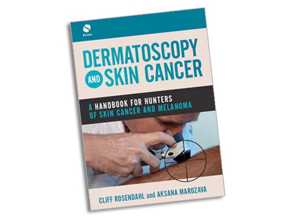 Prof Cliff Rosendahl and Aksana Marozava have just published their new book "Dermatoscopy and Skin Cancer: A handbook for hunters of skin cancer and melanoma". It's a great new tool for GPs learning and honing their skin cancer detection skills - lnkd.in/ftNqake #DermLite