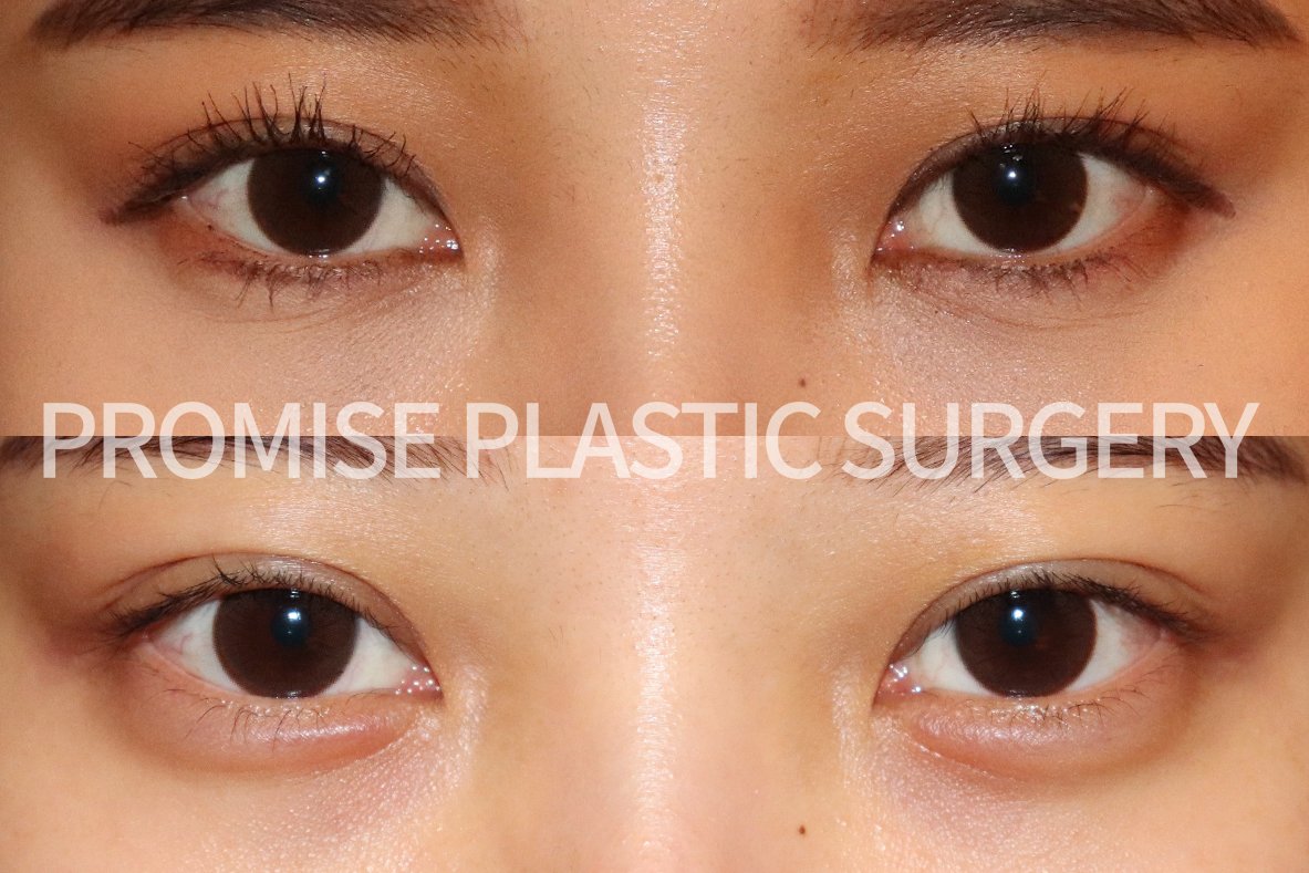 プロミス整形外科