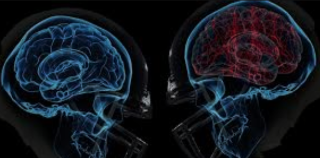 AthleticBiz's tweet photo. A new type of magnetic stimulation therapy may reduce symptoms of concussion: https://t.co/DDyuD1FAmd
#ABToday https://t.co/jmhvR0stSY