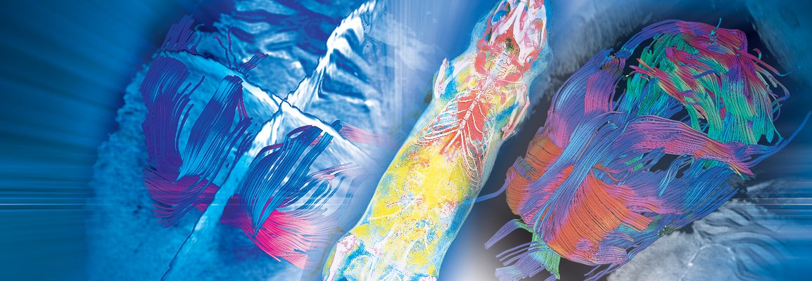 bruker's tweet photo. With its increased sensitivity, #magneticsusceptibility, and spectral dispersion, #UltraHighField (#UHFMRI) provides access to otherwise limited #researchtechniques such as #CESTImaging. Read this: Capitalizing on Higher Spectral Dispersion
https://t.co/gpbRhDy50L #Preclinical https://t.co/VyhyTBamtI