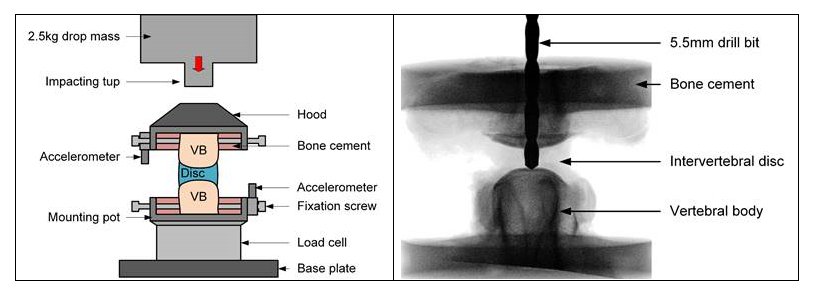 Nic won the 2019 Young Investigator Award from @SpineWebJournal for his just published paper investigating how loads are transferred through the intervertebral disc.  It will contribute to better treatment for lower back pain and injury. <a href="/ImperialBioeng/">Imperial Bioengineering</a> journals.lww.com/spinejournal/A…