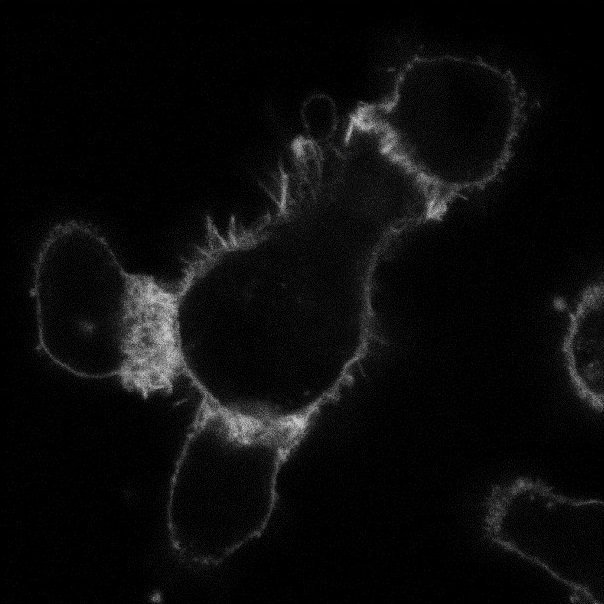 <a href="/BristolUni/">University of Bristol</a> Here are 3 white blood cells, called T cells, responding to a cancer cell. The 2nd image shows them use bright, tight structures to bind on tightly, but this can lead to the cancer cell killing them. Prof Christoph Wuelfing looks at how they could execute the job more effectively