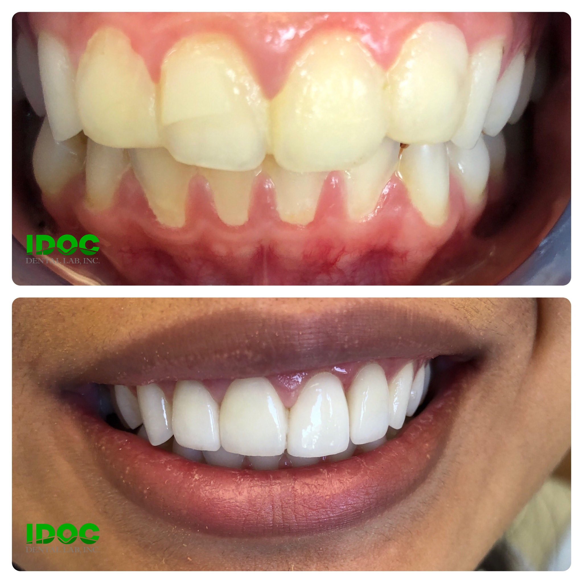 IDOC Dental Lab (IDOCdentalLab) / Twitter