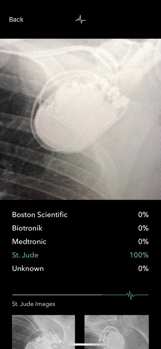 MGKatz036's tweet photo. AI/Machine learning we can use in #Cardiology and #EPeeps. Pacemaker ID, in App Store for iOS to identify ICD/PM vendor by taking a picture of can on CXR. H/t @datsunian https://t.co/XzlzzEvxVy