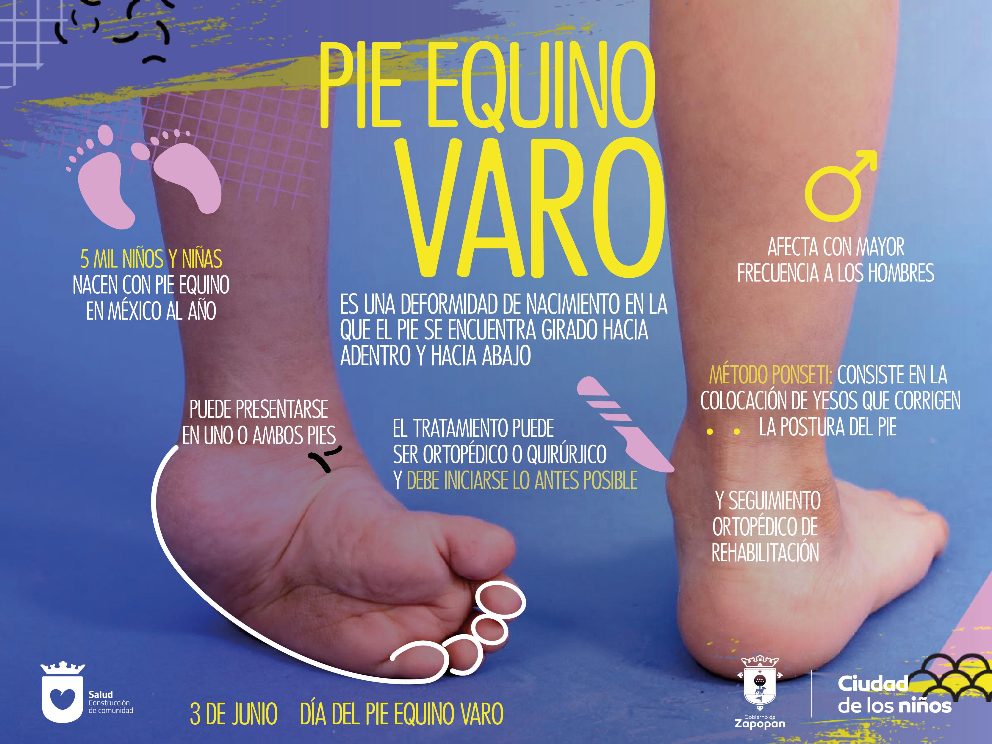 EFICACIA DEL MÉTODO PONSETI EN EL TRATAMIENTO DEL PIE EQUINOVARO