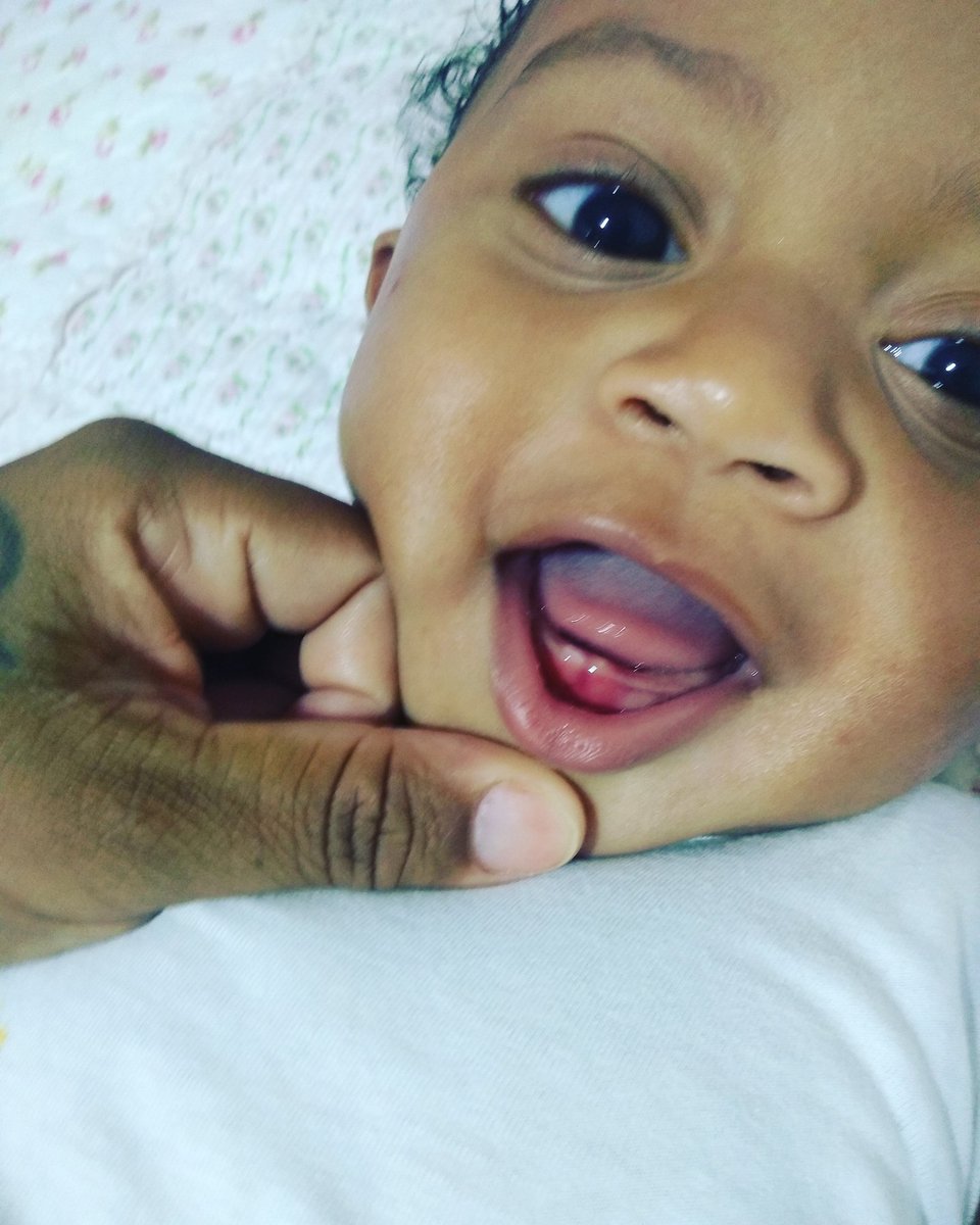 Jacki89Olegario's tweet photo. Olha ele aí 😍 o tal do Dente 🦷 Oficialmente nascido e o irmãozinho do lado já apontou tbm , gengiva rasgadinha já 🥰 #primeirodentinho #dentes #setemeses #davi https://t.co/vc251qrcTr