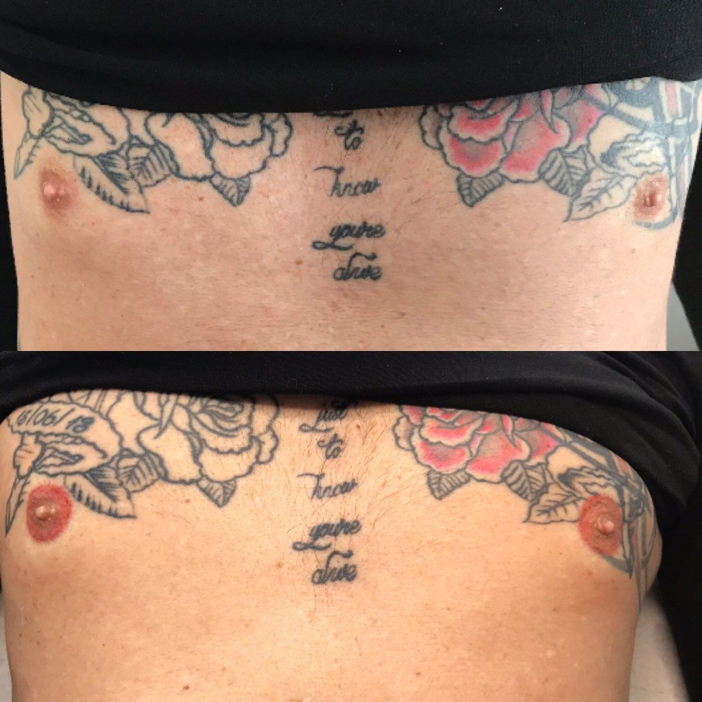 davispermcos's tweet photo. Areola &amp; Nipple Tattooing Is For Everyone https://t.co/1PLPvQTRU3 https://t.co/cXhzRt7pXR