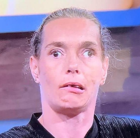 tb_lowe's tweet photo. "I've got a medical condition, its called a wandering eye."

Anton:

 #LoveIsland https://t.co/qduAiMHOnc