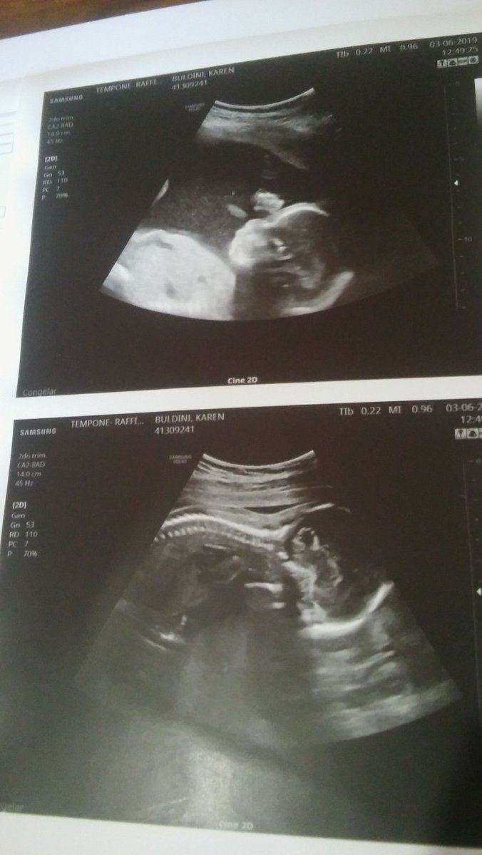 KBuldini's tweet image. 1/2 kg para el chanchito de mi hijo 💕, 63 kg para mi💆 bamos vien