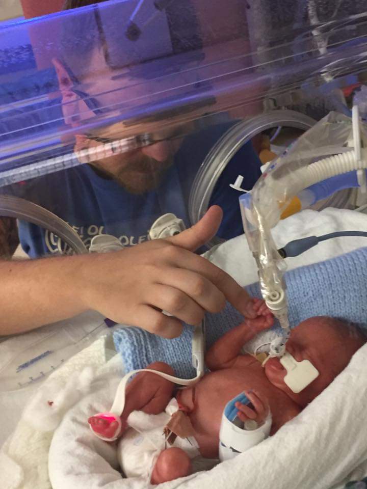 gardiner1985's tweet photo. Can't believe this ex 27 weeker, 1lb 14oz micro super hero, is 11 months old on Thursday. And we're now on count down towards his 1st birthday celebrations next month! #teamchase #thankyounhs #prem #nnu #nicugraduate #nearly1 https://t.co/UYhscdq0Ae