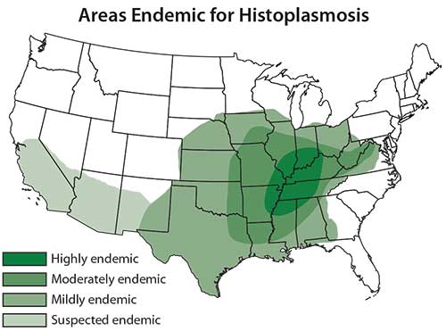 Areas endemic for histoplasmosis
