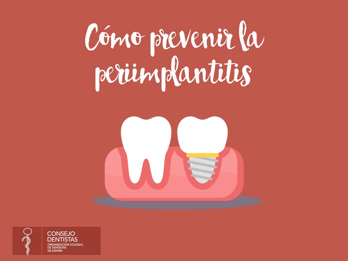 Aislamiento dental Clínica Dental Blay Monzo