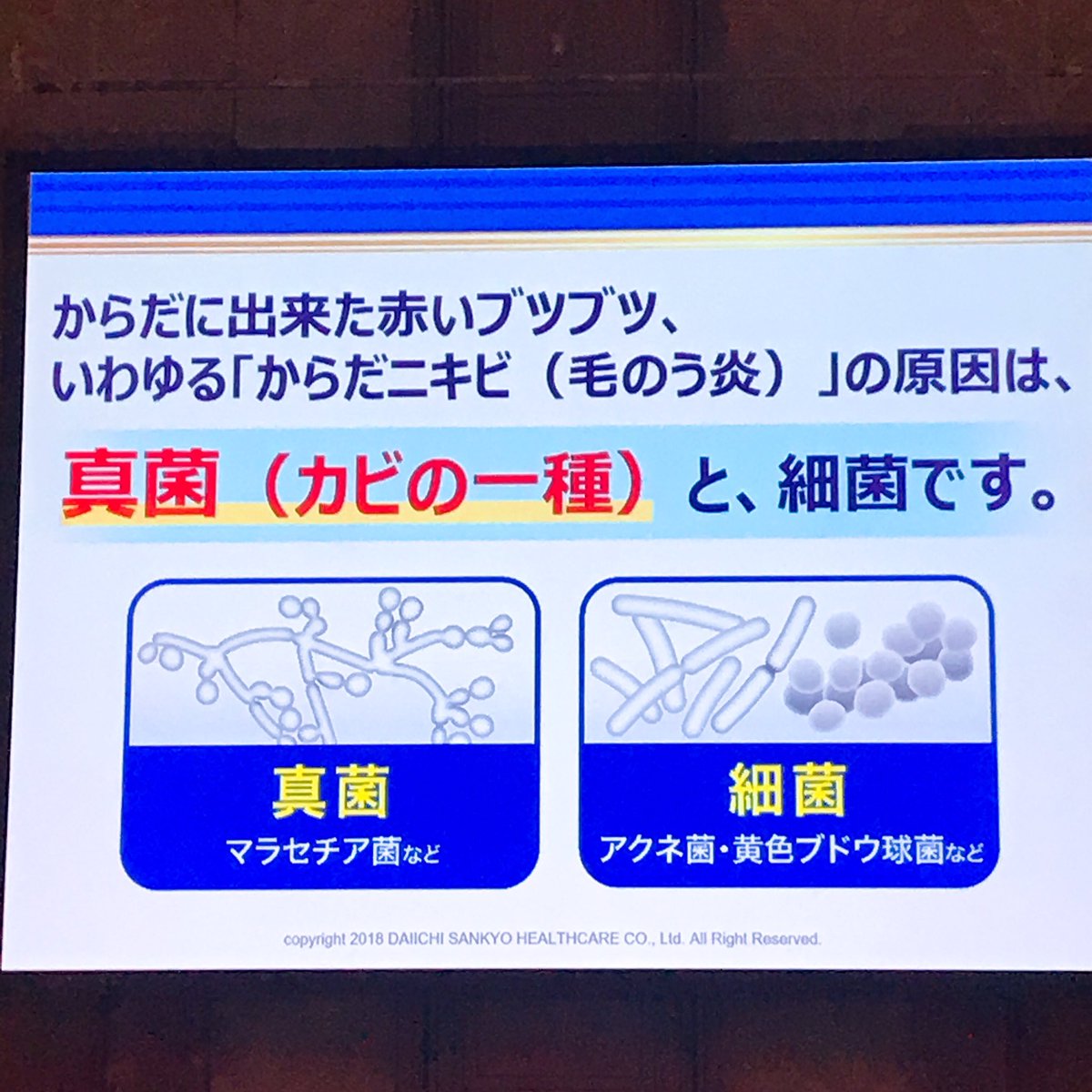 みな On Twitter 旦那の尻に塗りましたが 効きました ステロイド効かない時はこれね でも水虫には効かないみたい Rsp70 サンプル百貨店 第一三共ヘルスケア クロマイn軟膏