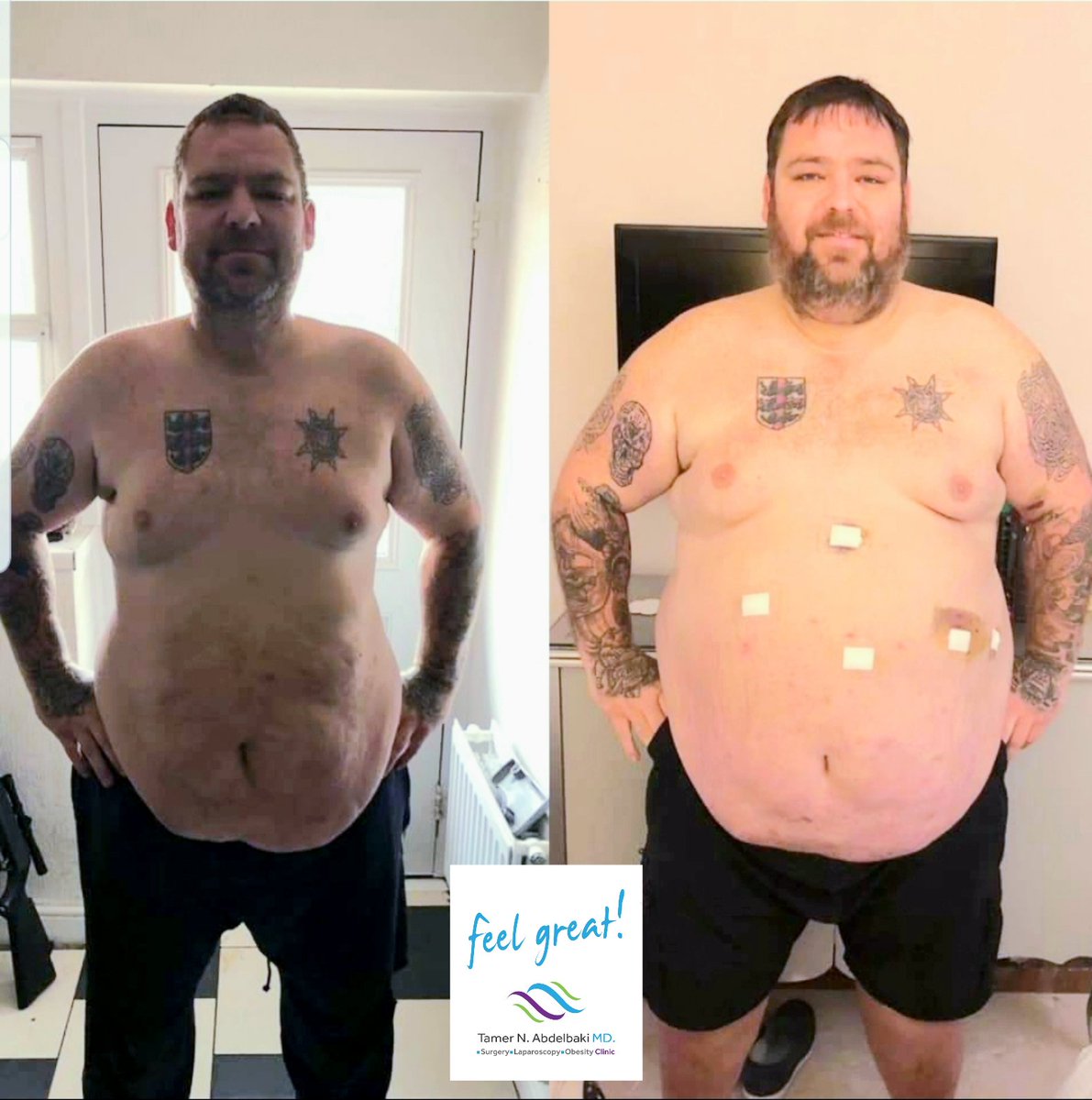 Tamerbaki's tweet photo. Congratulate Simon! 🇬🇧🇬🇧🇬🇧
Lost 60 kgs in 6 months.
Bravo Simon ⭐⭐⭐
.
.
سايمون من المملكة المتحدة .🇬🇧🇬🇧🇬🇧
فقد ٦٠ كجم في ٦ شهور.⭐⭐⭐
.
.
. https://t.co/BJelrDsMwN