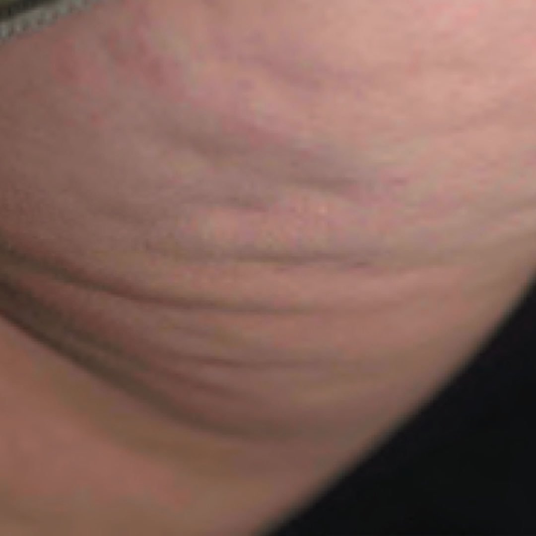 QuintalegreCME's tweet photo. ¡Aun estás a tiempo de decir adiós a la #celulitis y #grasalocalizada antes de las vacaciones! ¿Te gustaría? Escríbenos privado o llámanos al 958 176812 para cita con el equipo médico gratuita y sin compromiso. Diseñaremos tu programa 100% personalizado #granada https://t.co/hWt99MoLSD