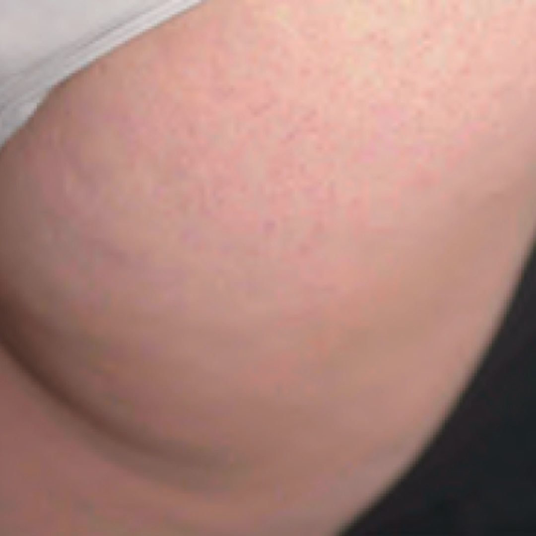 QuintalegreCME's tweet photo. ¡Aun estás a tiempo de decir adiós a la #celulitis y #grasalocalizada antes de las vacaciones! ¿Te gustaría? Escríbenos privado o llámanos al 958 176812 para cita con el equipo médico gratuita y sin compromiso. Diseñaremos tu programa 100% personalizado #granada https://t.co/hWt99MoLSD