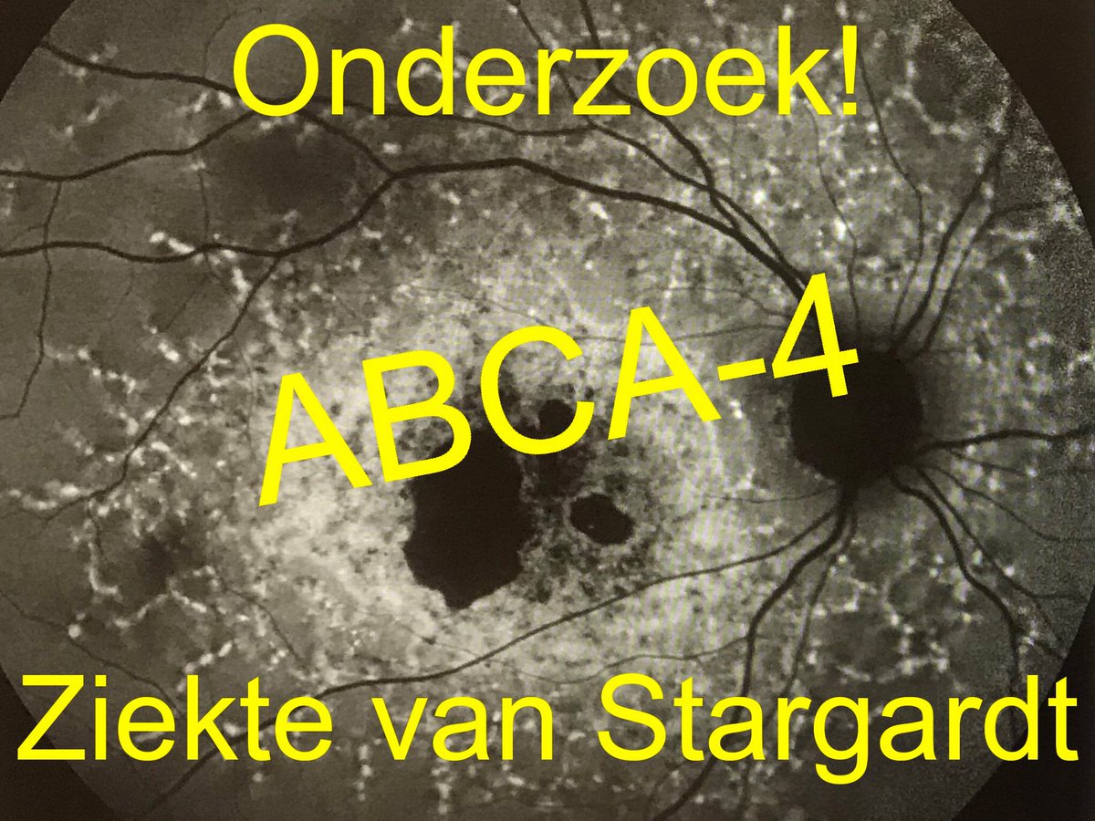 MaculaV's tweet photo. Multi-center klinische studie bij patiënten met de ziekte van Stargardt om de veiligheid en werkzaamheid van soraprazan te testen.

https://t.co/j1le8BrZSF https://t.co/wYu6FYlWVf
