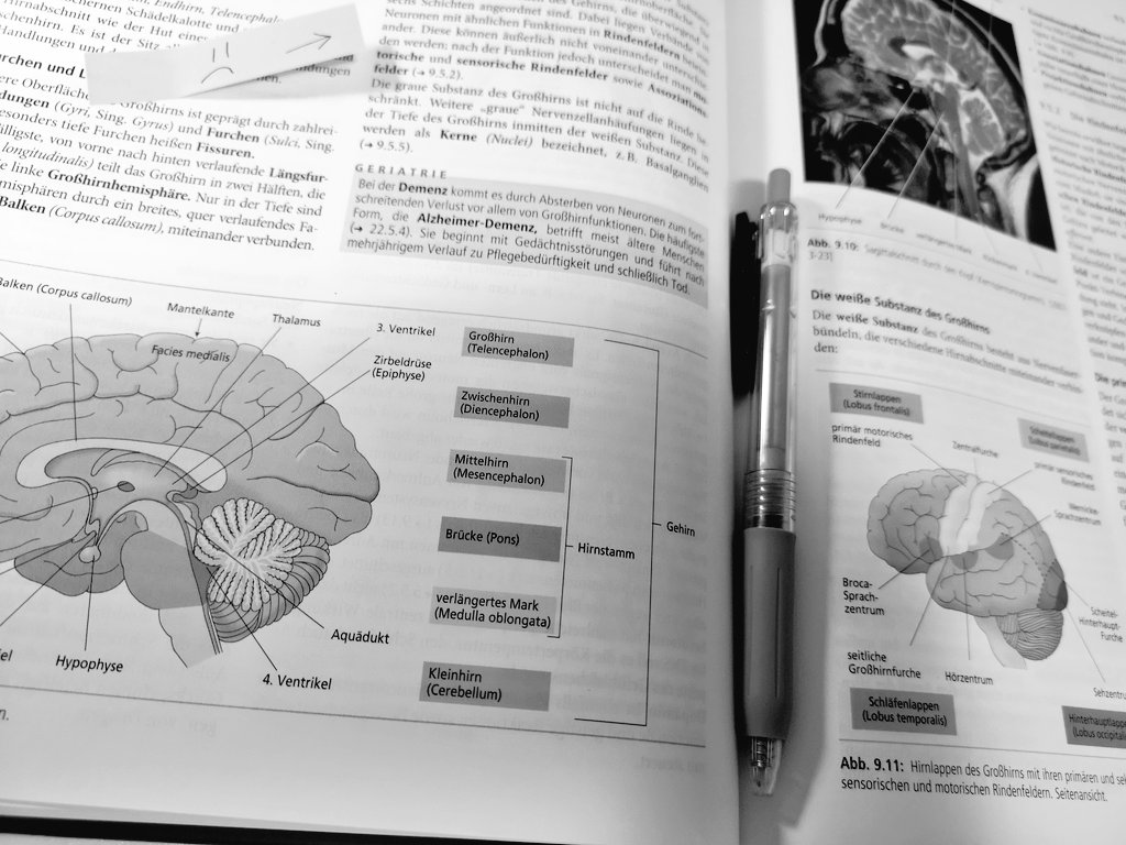 Ich und das Gehirn 🧠..

Wir werden nie Freunde werden 🙈
#study #auchnachmitternacht #nurse