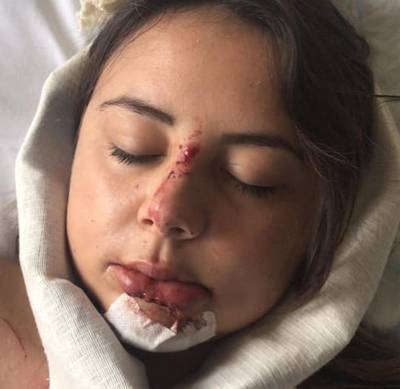 ds_veluwe's tweet photo. Veroorzaker ongeluk laat Michelle (21) uit Hattem bloedend achter en weigert 112 te bellen https://t.co/s5PUXf0lrR https://t.co/3jPW0KKNjS