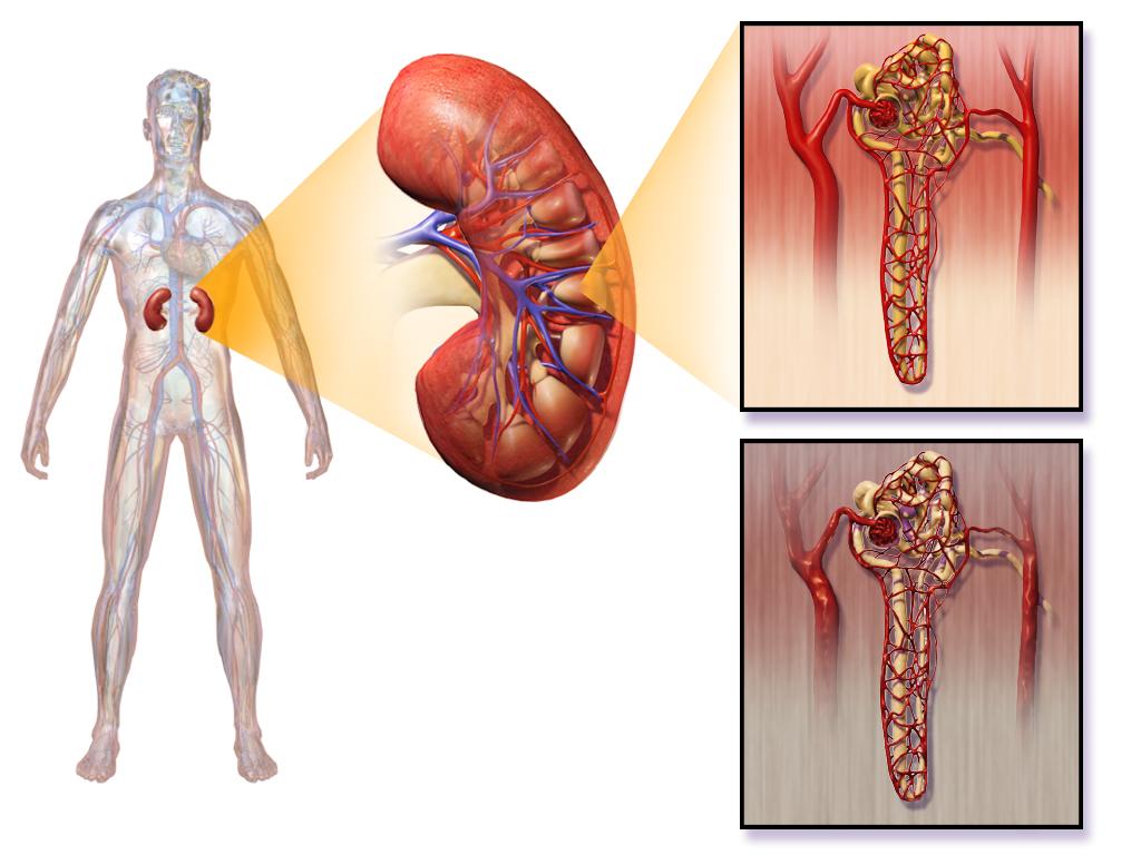 Major causes of Hypertension hypertensioncardiology.wordpress.com/2019/06/05/maj…