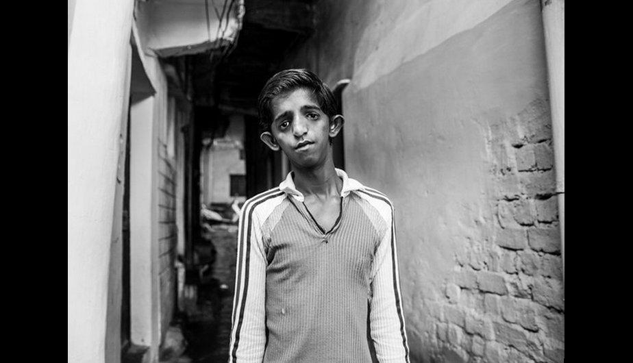 Marxista_NBA's tweet photo. Diciembre de 1984, Bhopal, India.
Fuga de productos químicos en la empresa estadounidense Union Carbide. 

Daños:

600.000 envenenados.
20.000 muertos.
150.000 personas en estado grave.

0 series, 0 películas, 0 conocimiento de la población. 0 críticas al sistema hegemónico. https://t.co/08AuJezzjr
