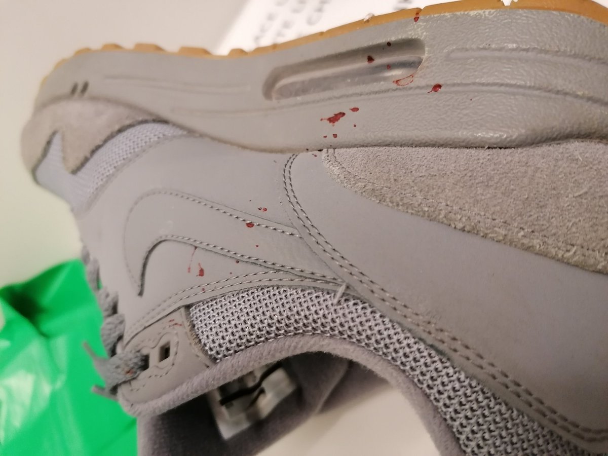 Oebs1's tweet image. New blood stained nikeys courtesy of the imperial crew. Sweet mate 👍

Scan done. 👊

What will be, will be 💚

#BowelCancer #cancer #bloodfire