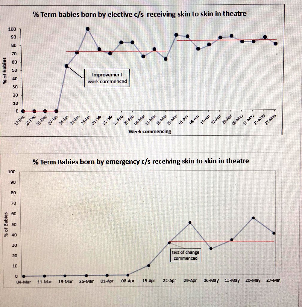 Fantastic work by mums and maternity team at UHW. Keeping mums and babies together by making skin to skin the culture even following caesarean birth.  #skintoskinScotlan
#SBAW2019 <a href="/nhsl_lqa/">Lanarkshire Quality Approach</a> <a href="/NHSLanarkshire/">NHS Lanarkshire</a>
<a href="/annie3bruce/">AnneMarie Bruce</a>
<a href="/lorna_lennox/">Lorna lennox</a> <a href="/janehardie1/">jane telfer</a> 
<a href="/mcqicspsp/">SPSP Perinatal and SPSP Paediatric Programmes</a>