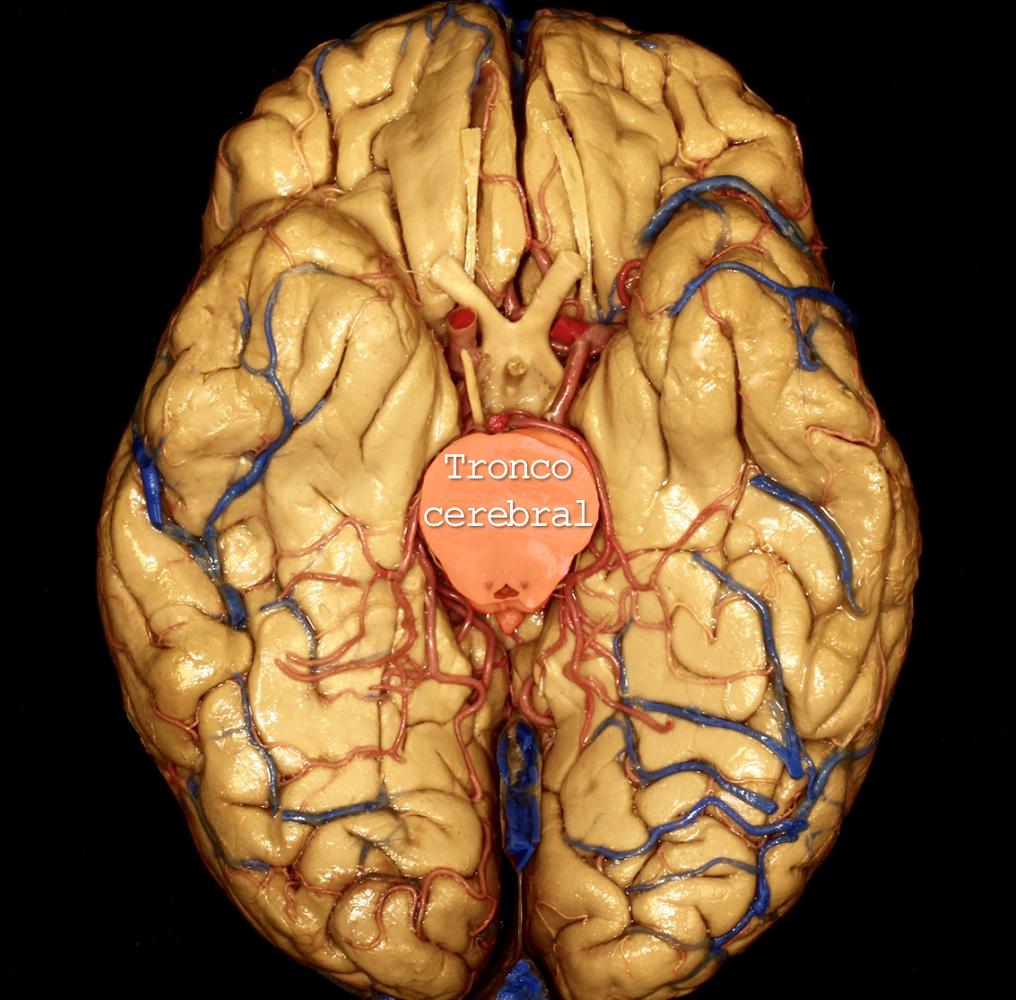 aeducar's tweet photo. Superficie cerebral basal 🧠
✅ | Leer: https://t.co/ujziy2OV8V
✒️ | Autor: Dr. Facundo Rodríguez, médico neurocirujano.
#anatomia #neuroanatomia #cerebro #craneo #cerebelo #troncocerebral #poligonodewillis #lobulofrontal #lobulooccipital #lobulotemporal #asociacioneducar https://t.co/cfHcclkooh
