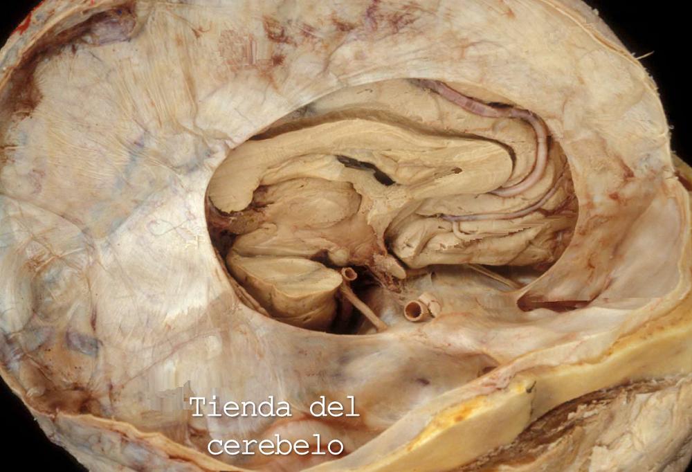 aeducar's tweet photo. Superficie cerebral basal 🧠
✅ | Leer: https://t.co/ujziy2OV8V
✒️ | Autor: Dr. Facundo Rodríguez, médico neurocirujano.
#anatomia #neuroanatomia #cerebro #craneo #cerebelo #troncocerebral #poligonodewillis #lobulofrontal #lobulooccipital #lobulotemporal #asociacioneducar https://t.co/cfHcclkooh