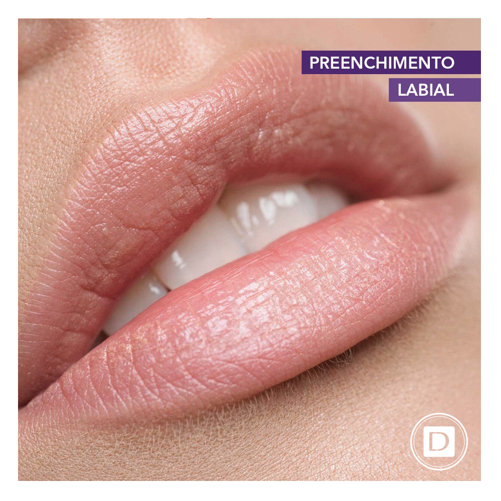 ClinicaDerm's tweet photo. Preenchimento labial. Quem não tem vontade de ter uma boca mais bela? Ou então, sentiu perda no volume e afinamento dos lábios? Ou medo de ficar exagerado?

Leia mais acessando o link: https://t.co/XRo7DgnUFQ https://t.co/JMT38LlKoA