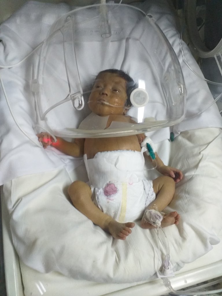 beluu_gallardo's tweet photo. Seguimos buscando, todos podemos ayudar 💖 mi sobrinita Emma tiene 14 días de vida y le están haciendo transfusiones de sangre 3 veces al día, necesita con URGENCIA los donantes 🙏🙏 https://t.co/dLbsA1uRWV