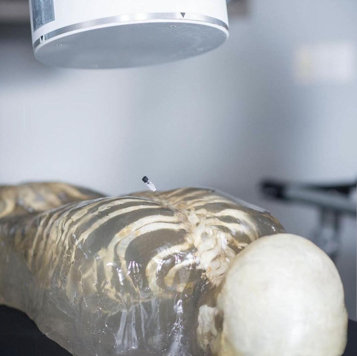 USAnesthesia's tweet photo. The New Gold Standard in cadaver training and physician education? BioTras
#PainManagement #painrelief #Training #chronicpain #cadavertraining https://t.co/MNSoIOKyPf
