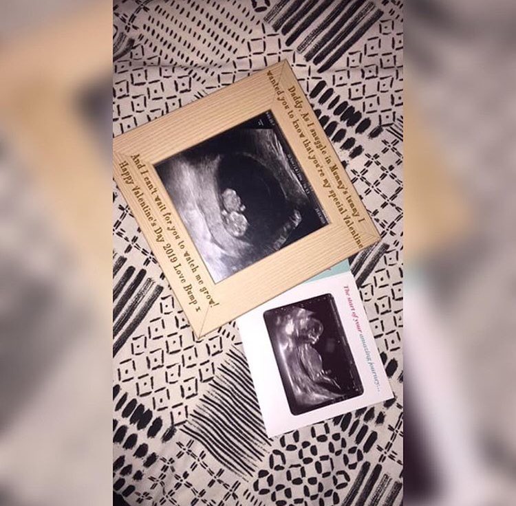 Francottam's tweet photo. 11 weeks 2 days until your due date, not long now baby girl. I can’t wait to see your beaut little face. You cheer me up so much before even meeting you - your little bendy back always makes me smile. 100% little miss awkward like mummy. I love you more than you’ll ever know🎀 https://t.co/AEcO2oLmZ5